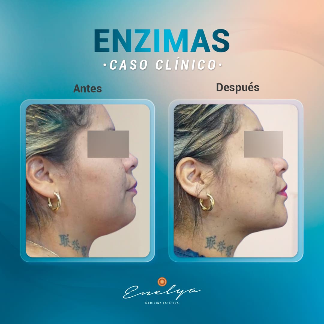 Enzimas-enelyaperu
