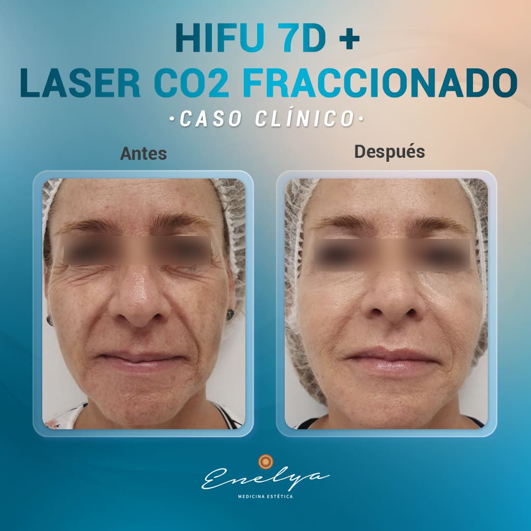 Eternal-Skin-360°-Enelya