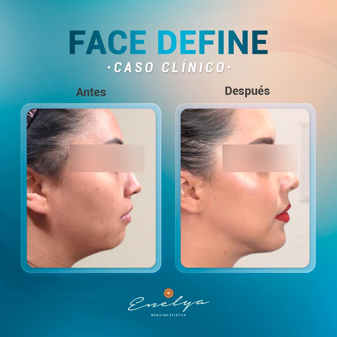 Face-define-enelyaperu